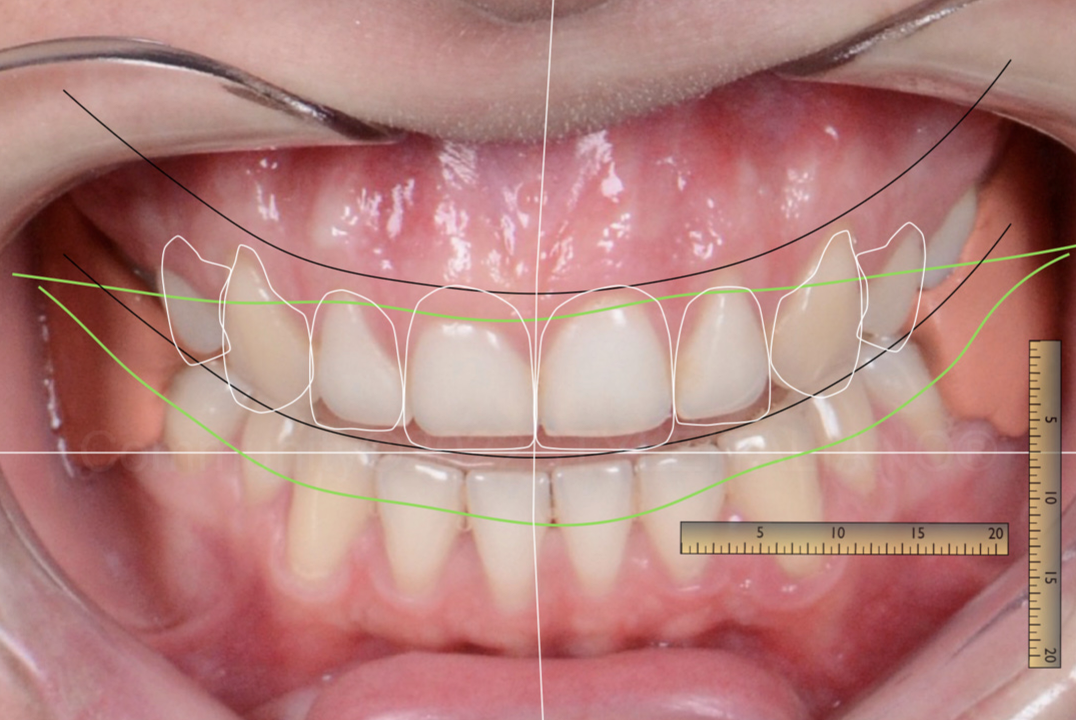 Odontología estética